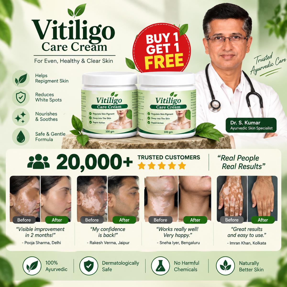 Vitiligo® Care Cream – Buy 1 Get 1 FREE